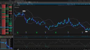 6.11.26 Daily Trading Cheatsheet: Dentsply Sirona, Inc. (NASDAQ: XRAY)