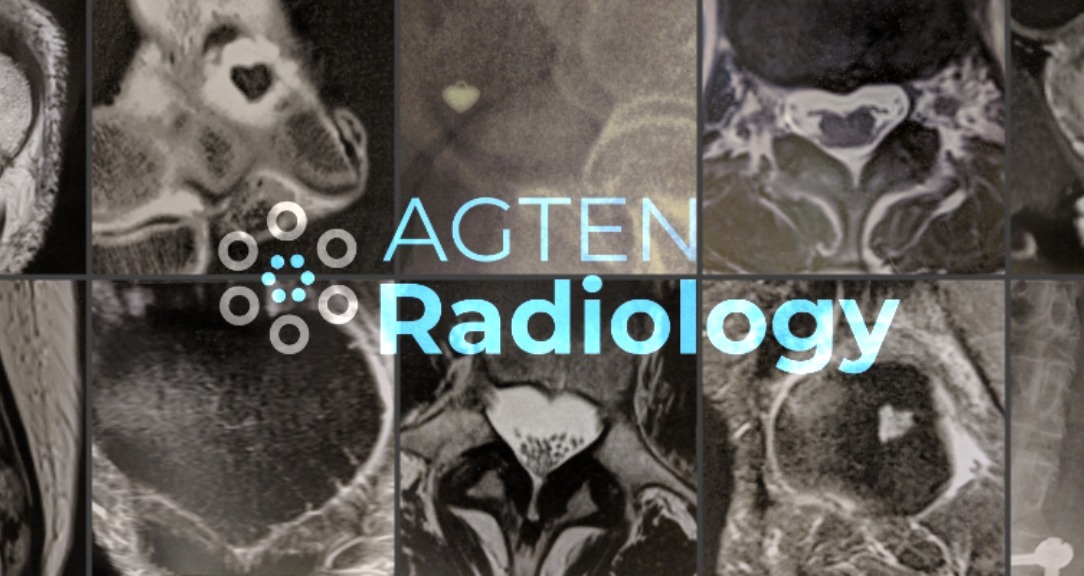 Agten Radiology Patreon