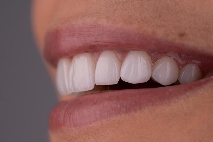 Smile Dental center Miami group