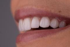 Smile Dental center Miami group