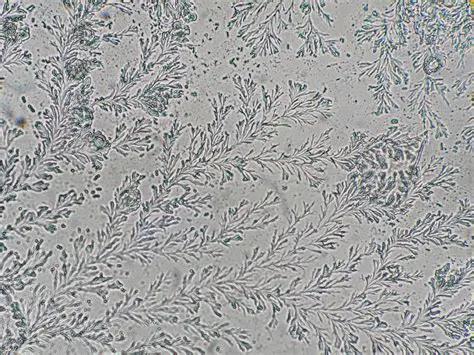 'CYCLE TRACKING' | 11th of February