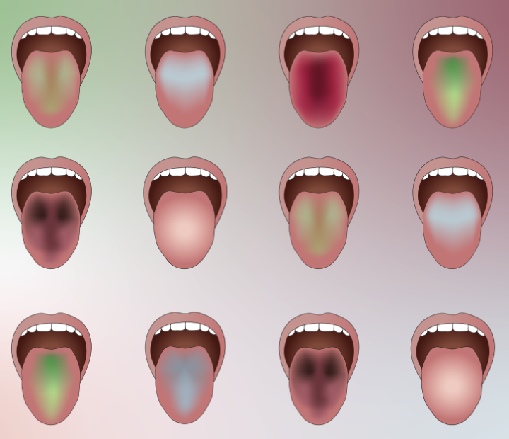 What colour is your tongue?
