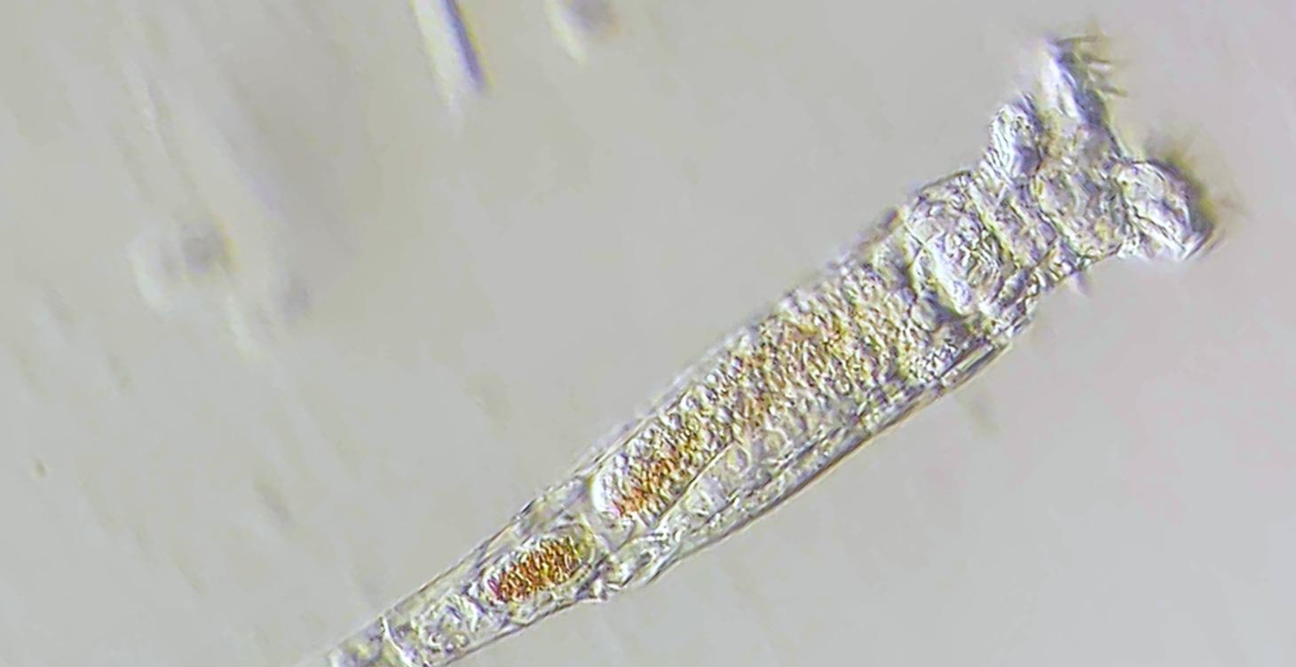How microscopes work, and how to buy a microscope
