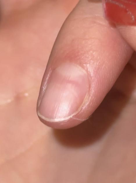 ✨Cuticle Area Damage — What These Lines Really Mean✨