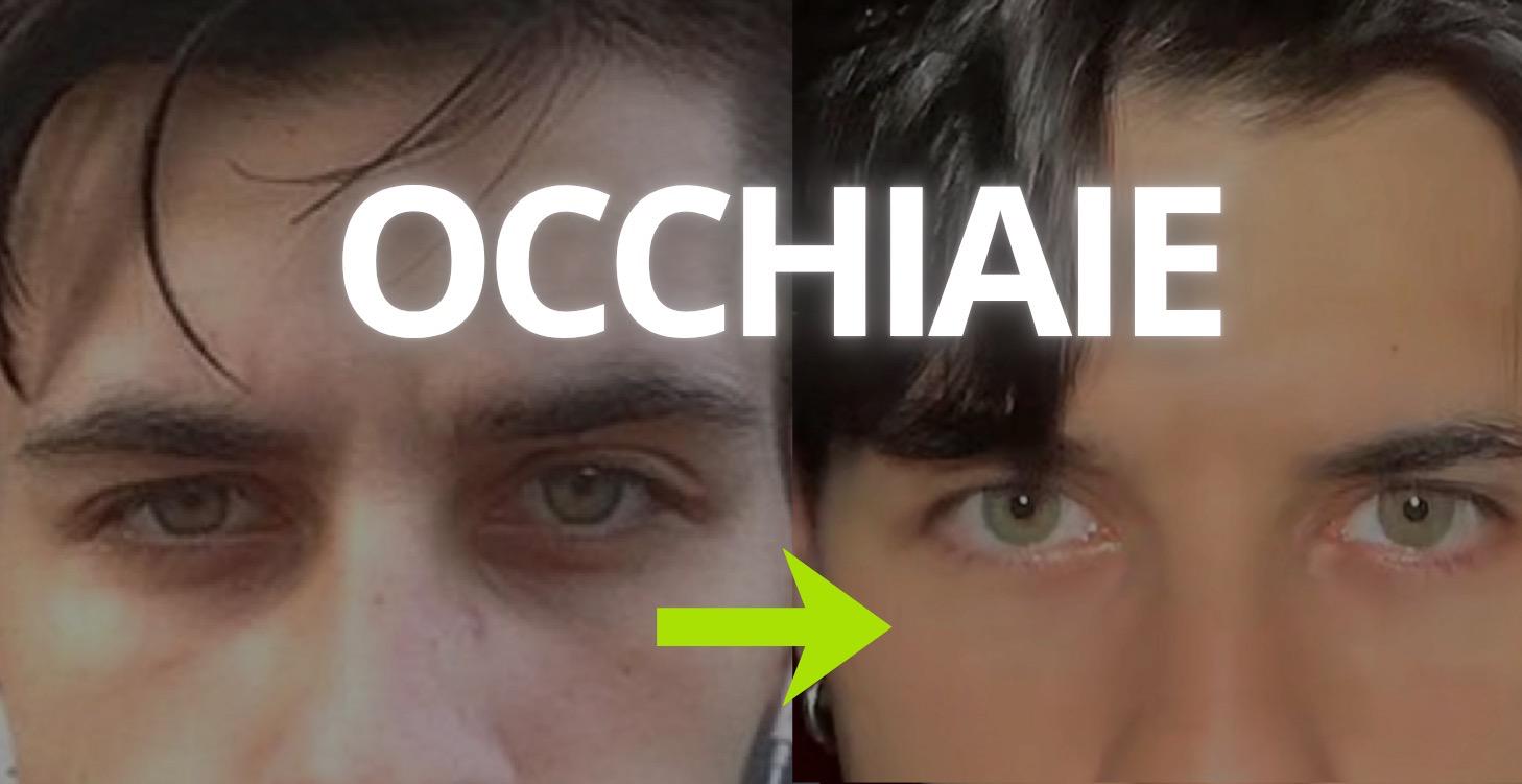 OCCHIAIE