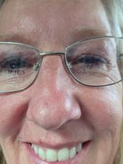 Lisbeth Schiønning