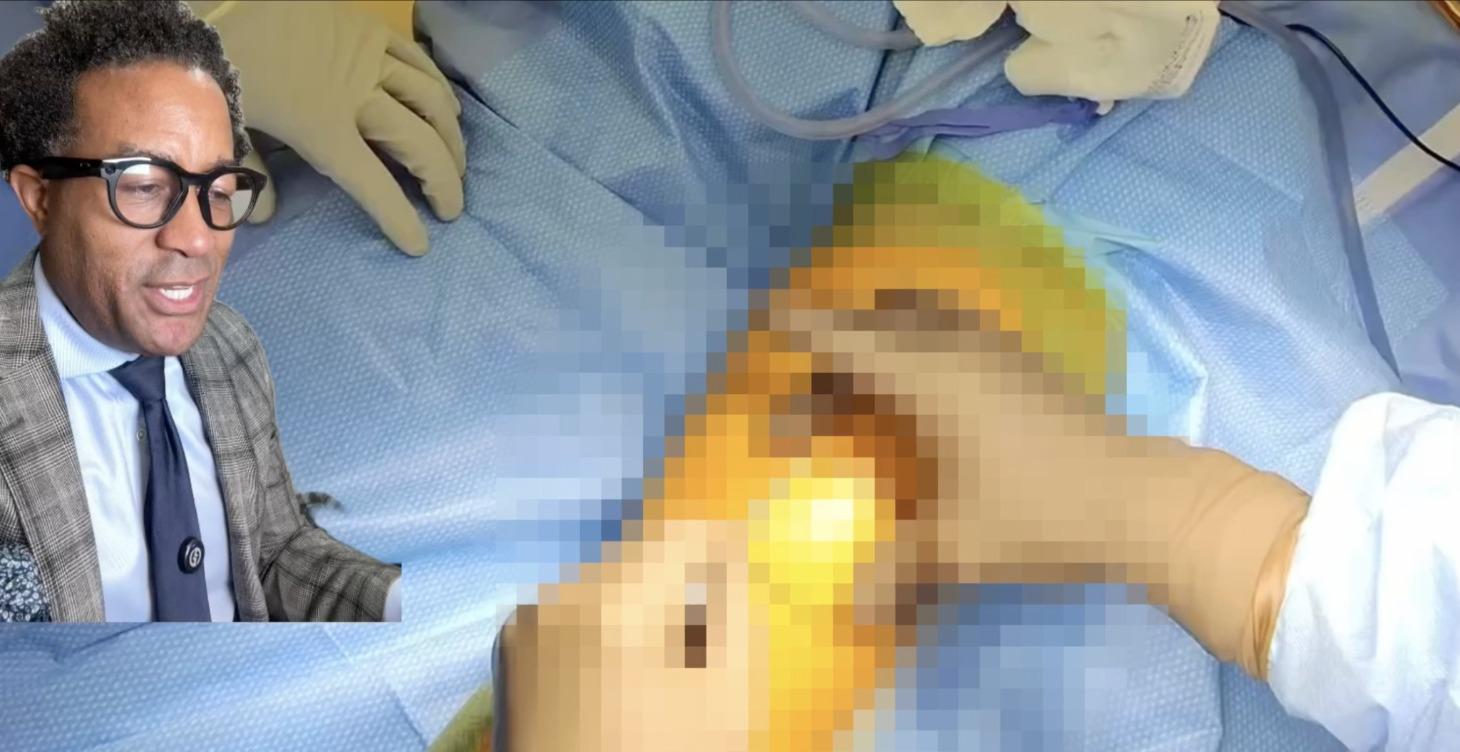 Bone Skool - Intro to ortho surgery: TKA