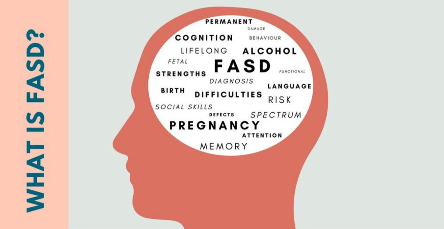 What FASD Really Is :Why Most Systems Get It Wrong