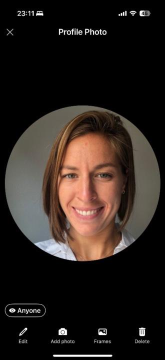 Merlina Fiorino Axpe