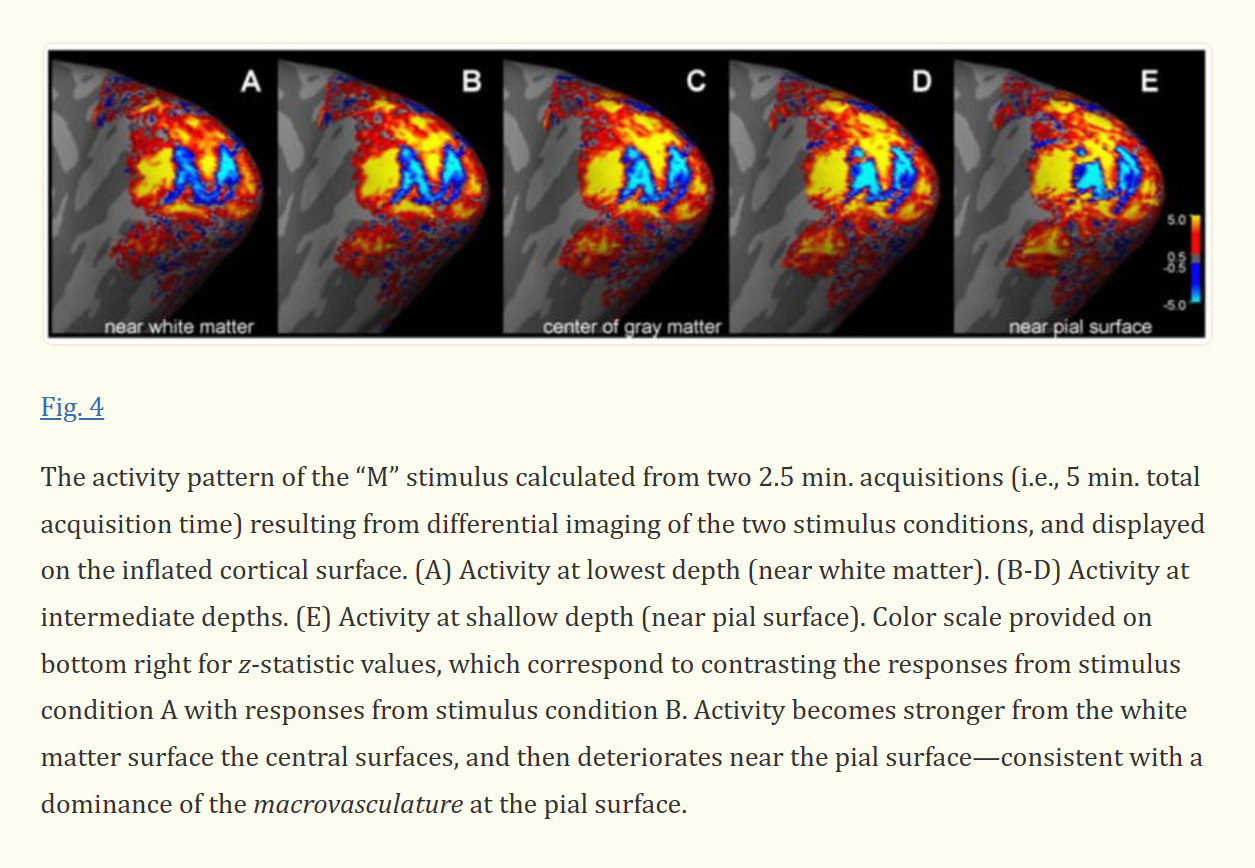 letter M in the brain.PNG