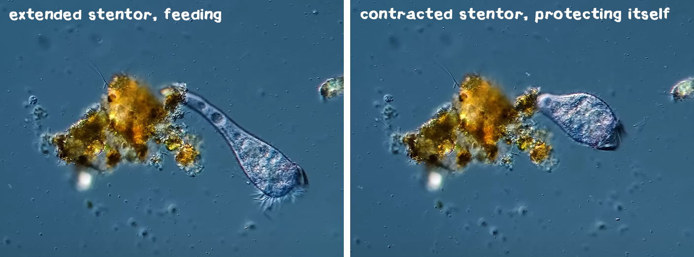 extended and contracted stentor.png