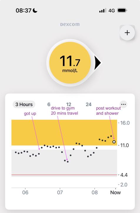 Crazy Numbers or failing CGM?