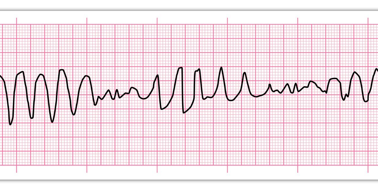 Prehospital ECG Course