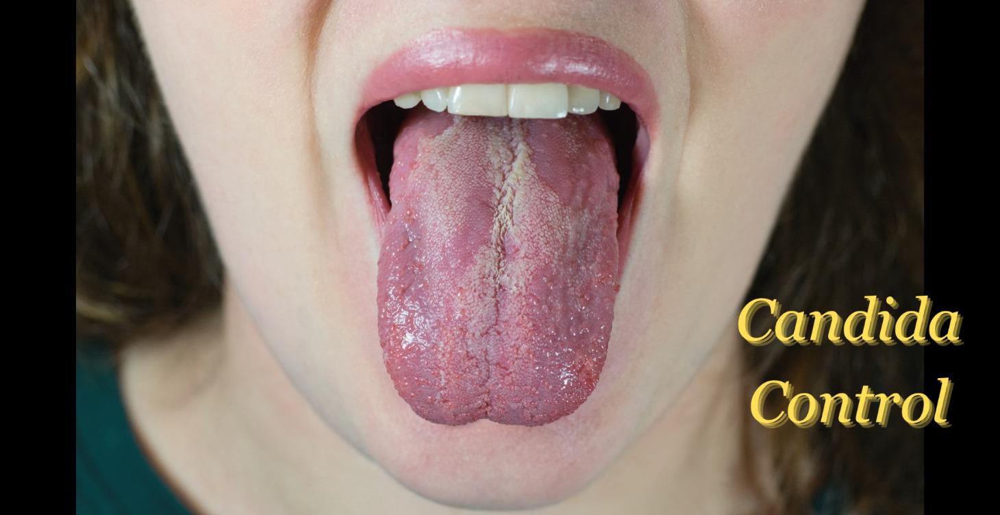 Candida Control - Step 1 to Health Freedom