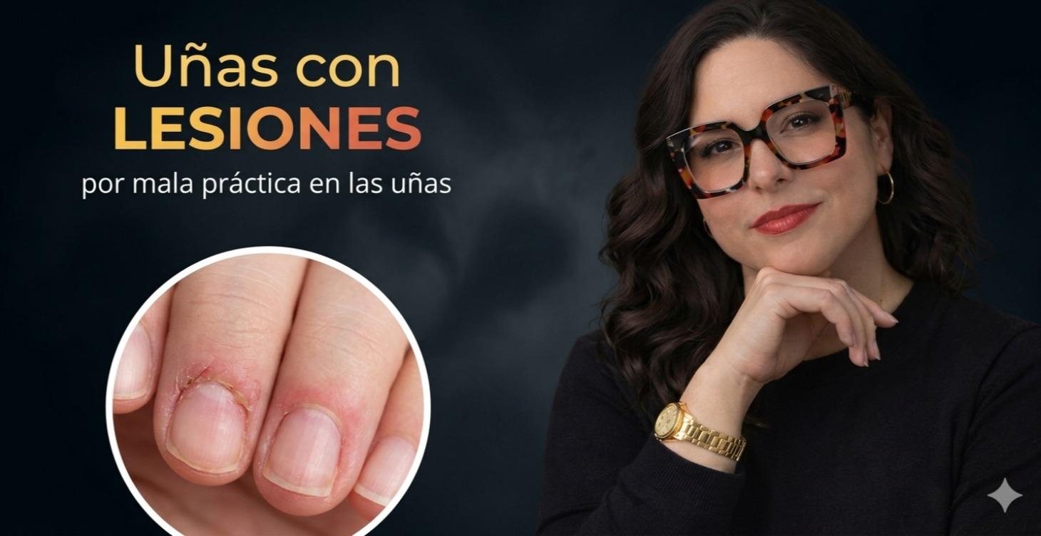Uñas con lesiones por mala práctica profesional #5