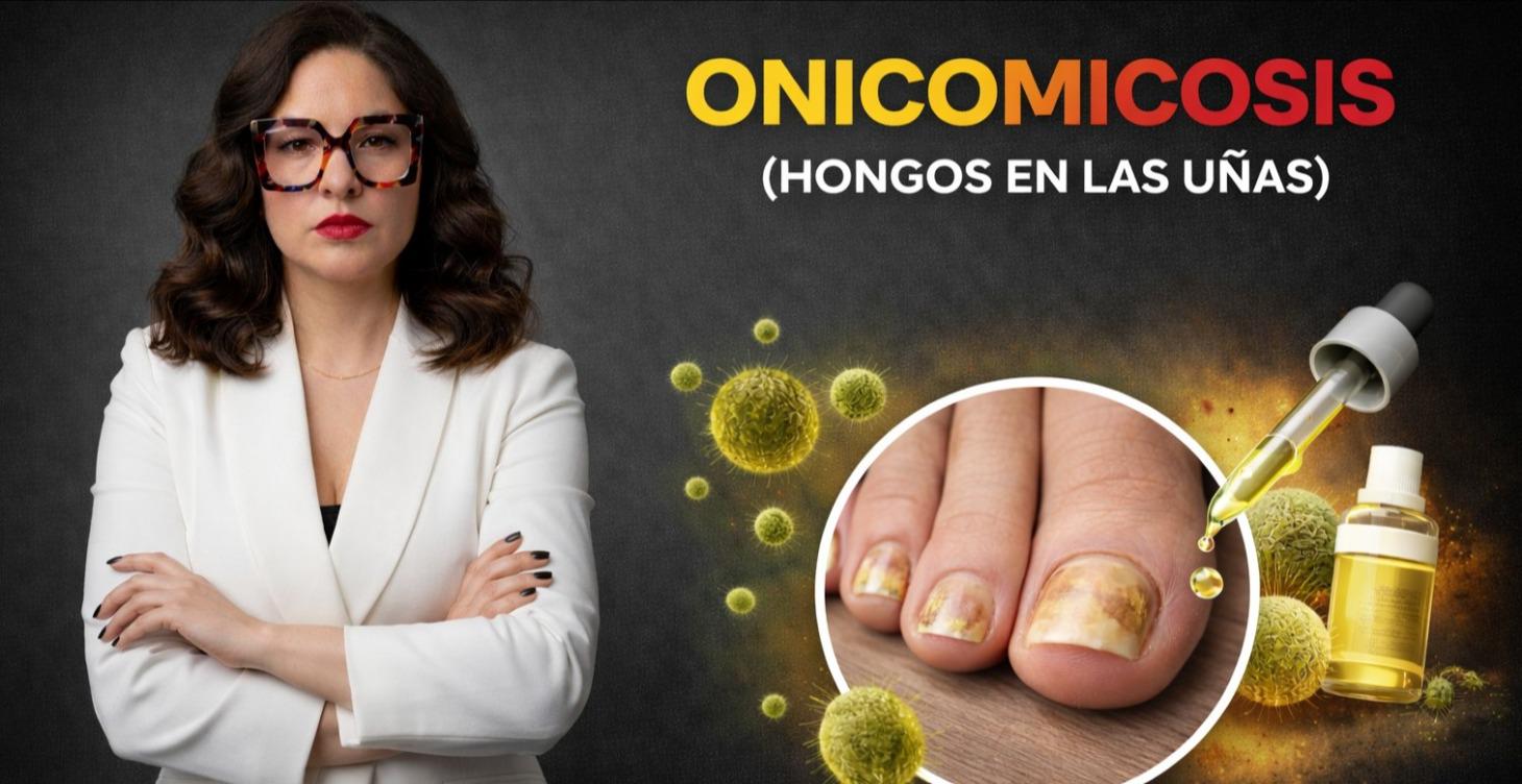 Onicomicosis (Hongos en las uñas) #2