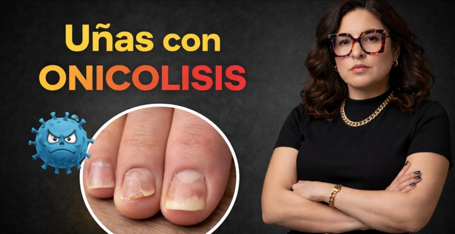 Onicolisis (Desprendimiento de la uña) #3