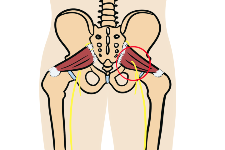The Anatomy Behind Piriformis Syndrome (Pun Intended)