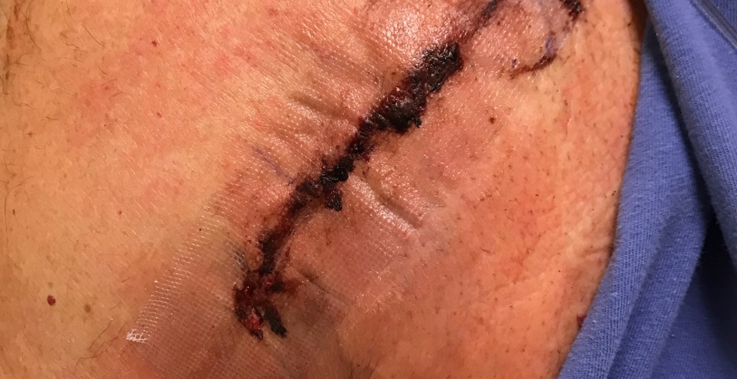 Shoulder, Back, Hip and Knee Longevity with EMS