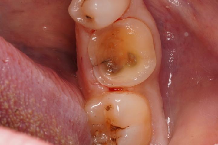 Marc Coumarakichenane