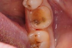 Marc Coumarakichenane