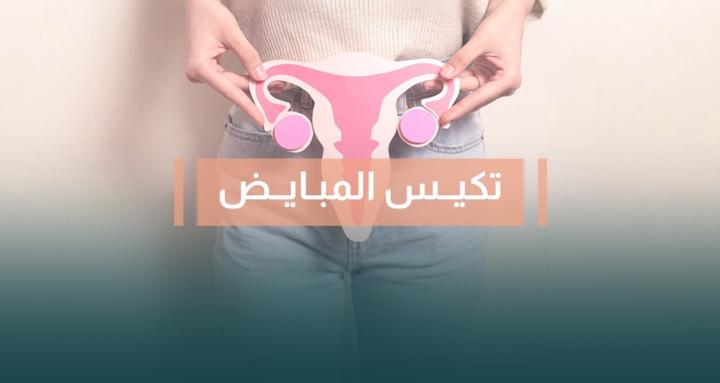 تكيس المبايض 