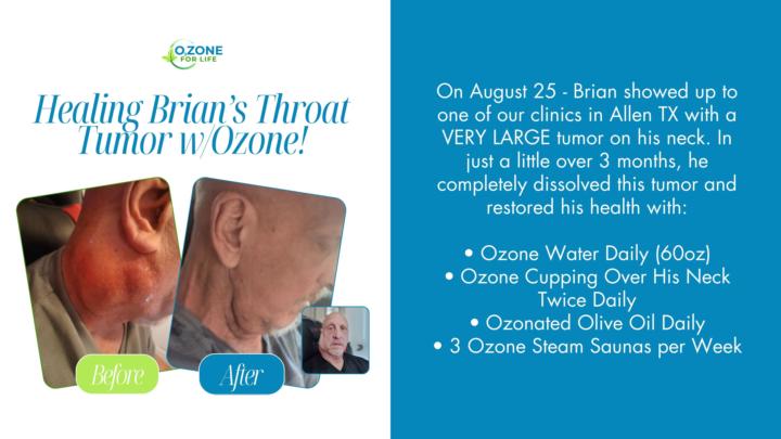 🔥 How Brian Dissolved a Massive Neck Tumor in 90 Days Using Oxygen + Ozone Therapy