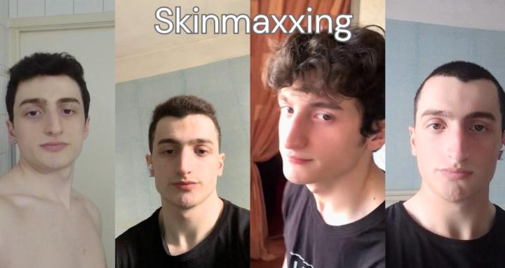 Skinmaxxing