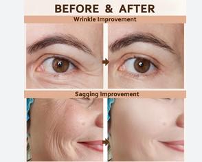 SILK PEPTIDES: WHAT ARE THEY AND WHY DO I NEED THEM IN MY LIFE?