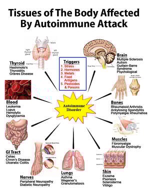 SMOLDERING SUNDAY: AUTOIMMUNITY