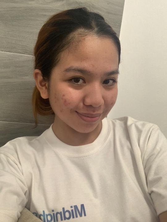 Aj Uson