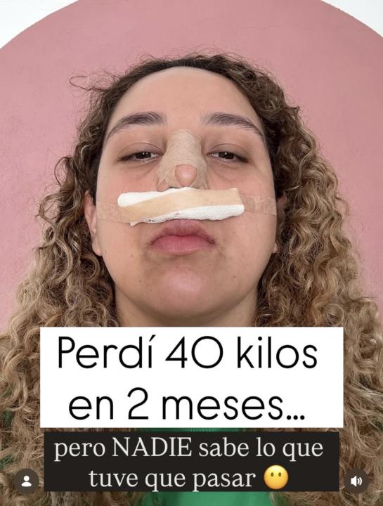 “Perdí más de 40 kilos… respirando con media nariz.”