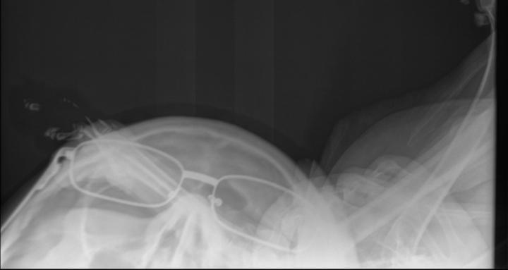 Sage Radiation Safety