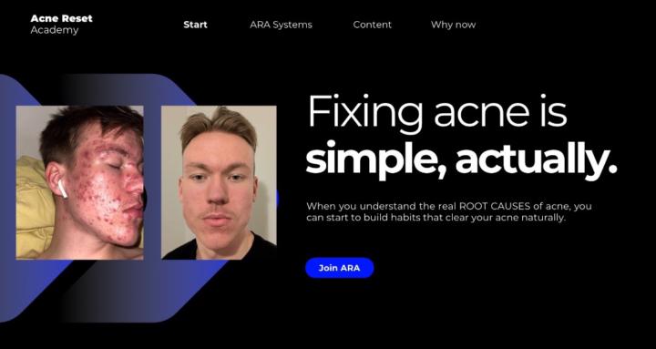 Acne Reset Academy