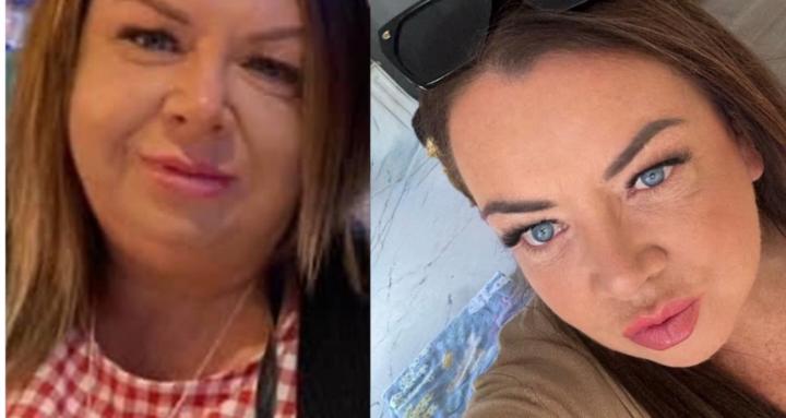 Gastric sleeve-bodybuilding