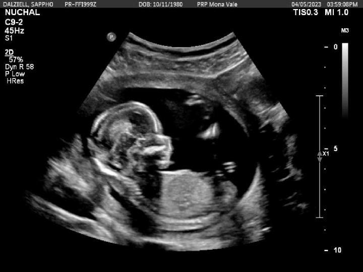 All thanks to Fi, we have baby no.3!!!