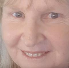 Jo Atkinson
