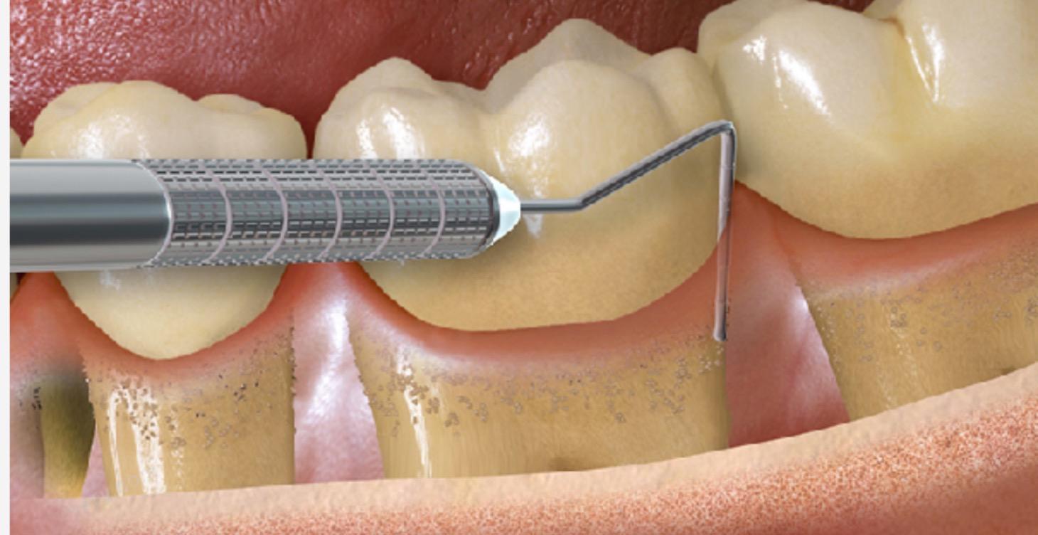 Intensivo Periodoncia