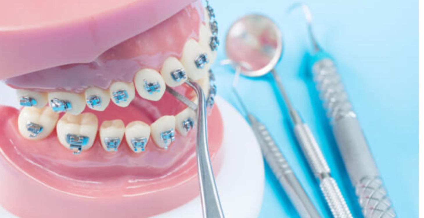 Intensivo Ortodoncia