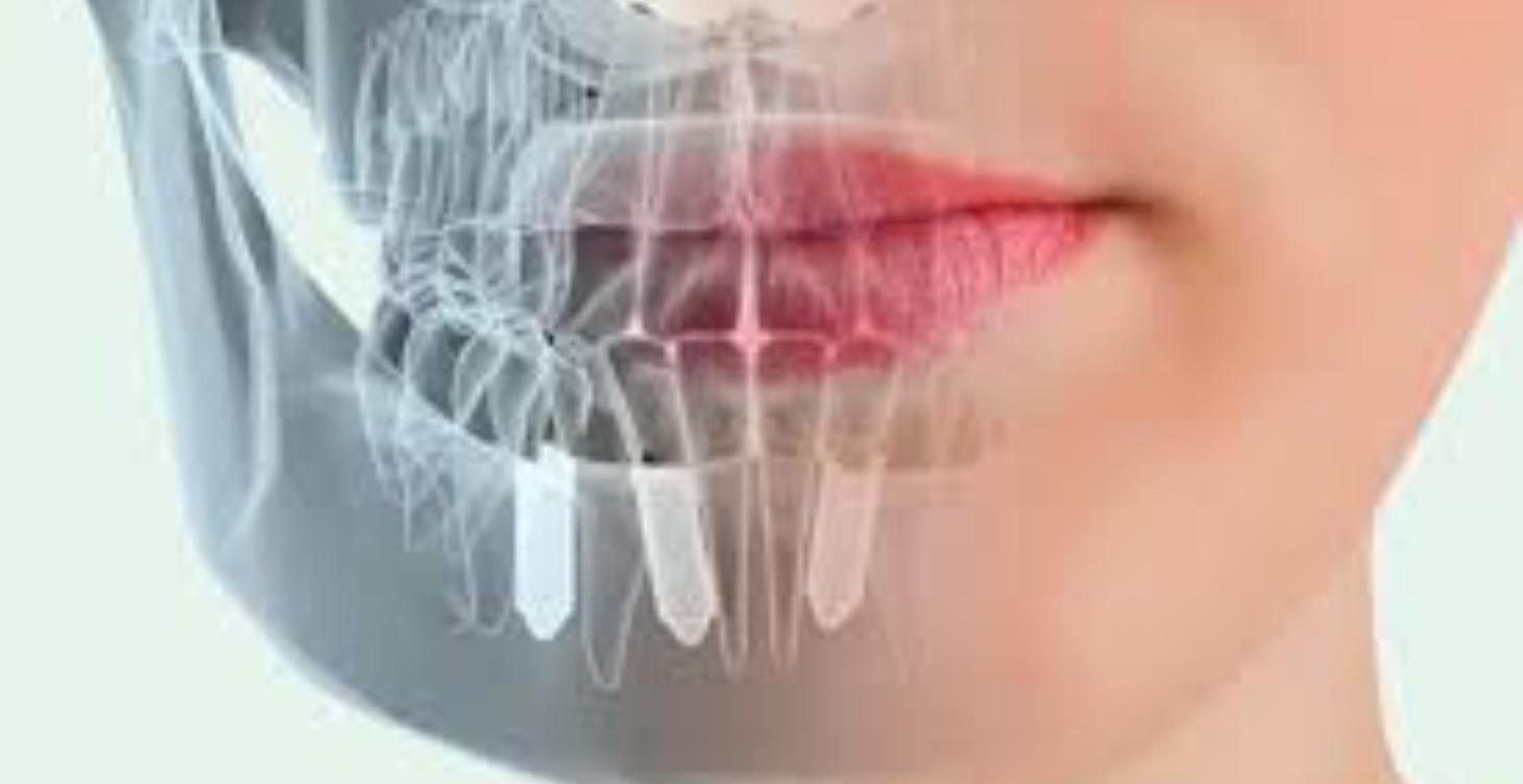 3 dias intensivo Cirugia E implantes