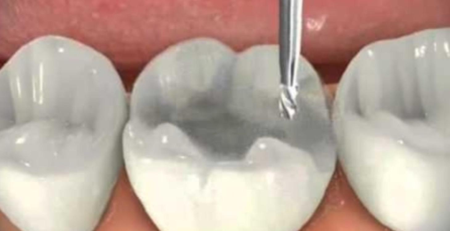 Intensivo Operatoria