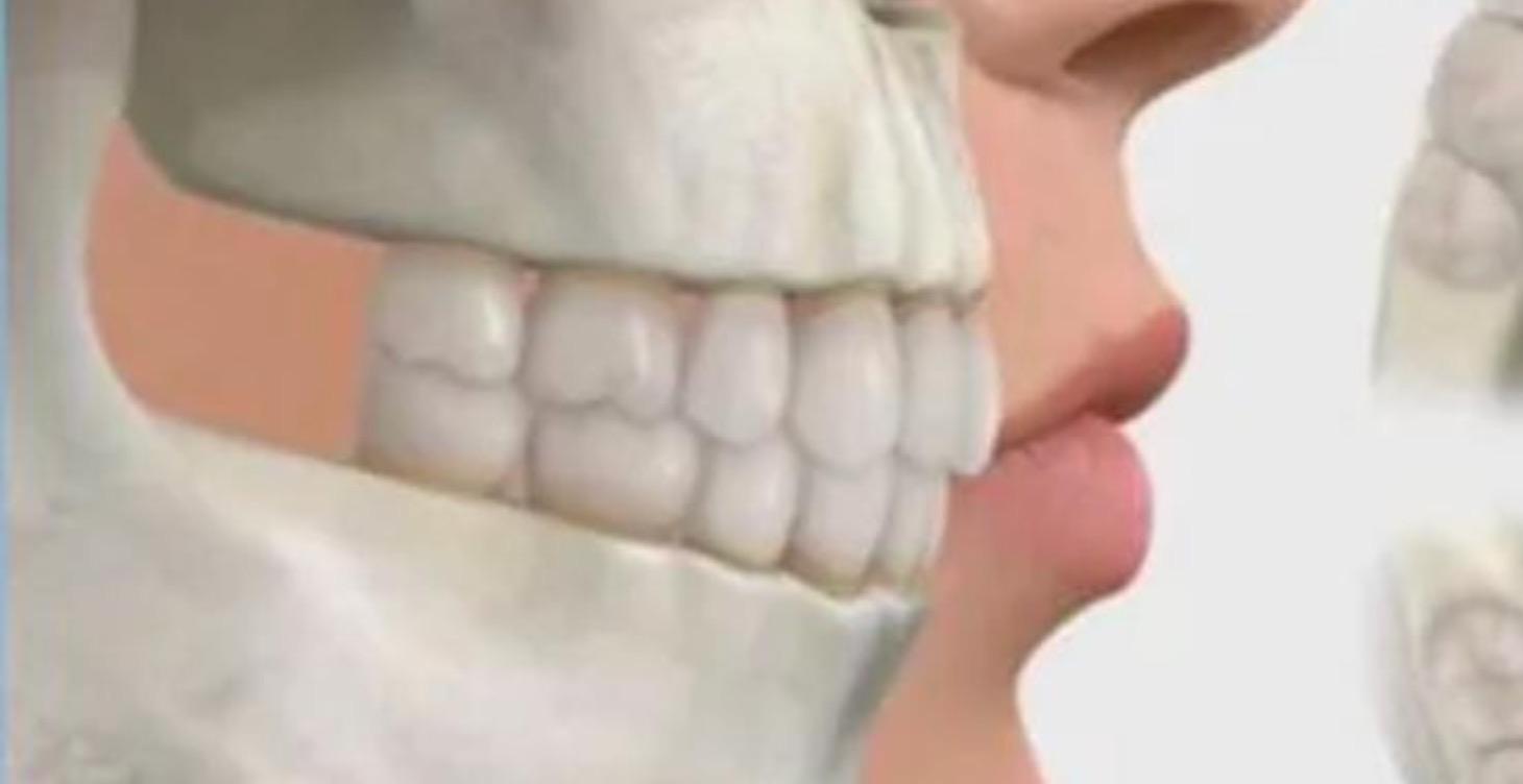 Intensivo Oclusión 3 Días.