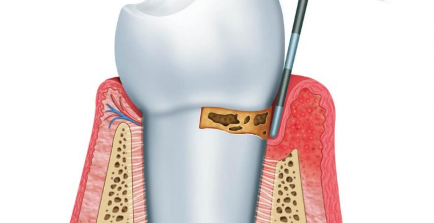 Intensivo Periodoncia