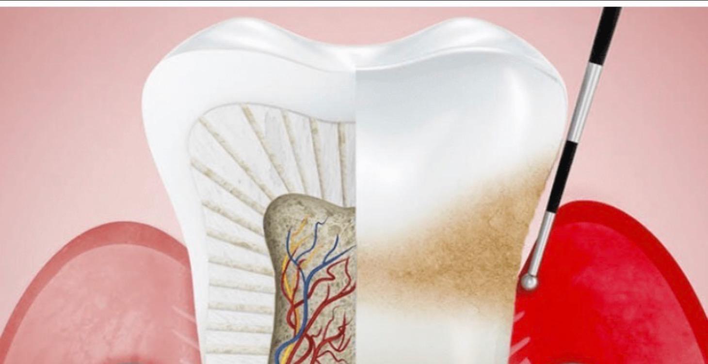 Intensivo Periodoncia 3 Días