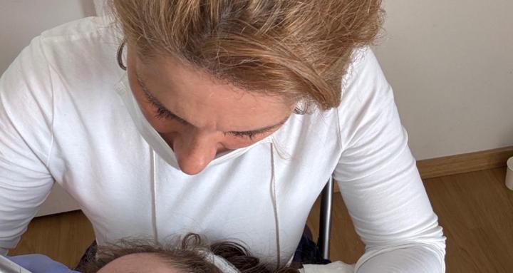 Belleza y Microneedling