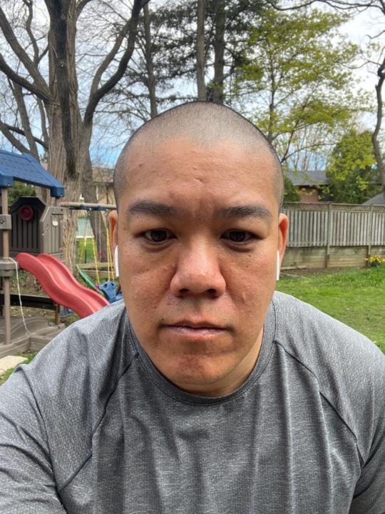 Kevin Fung