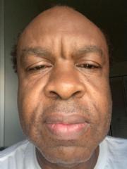 Garry Millien