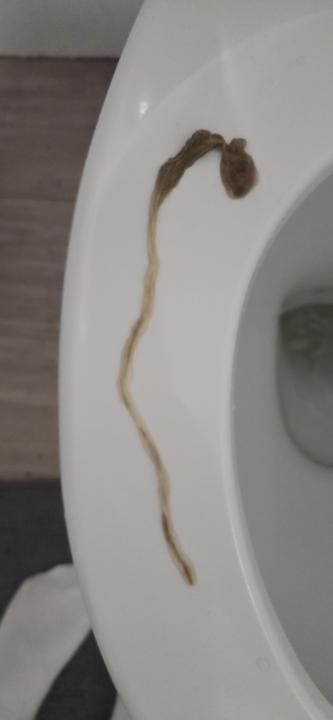 Enema update day 19 🦠🪳♡