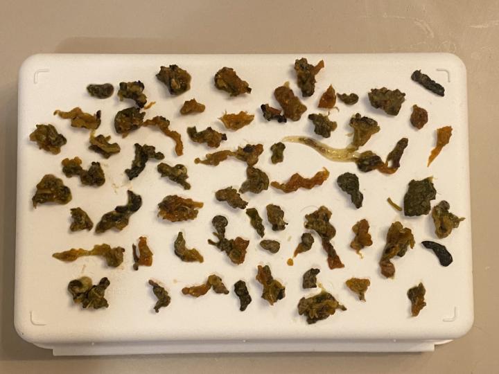 Flashing out parasites after liver  detox