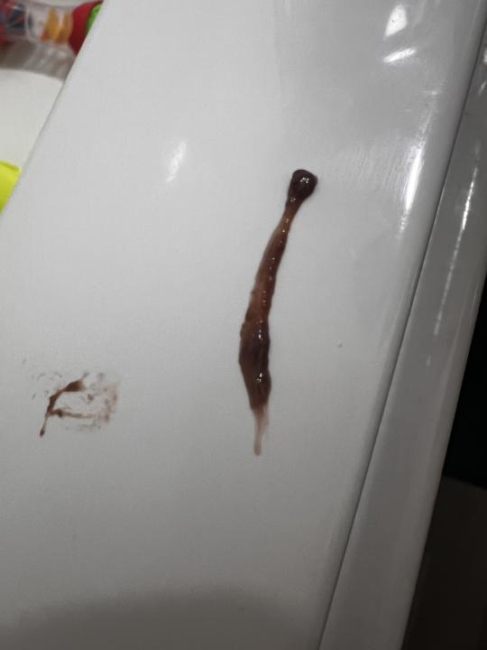 🚨 LOOK WHAT JUST CAME OUT OF ME!!! 😳🪱